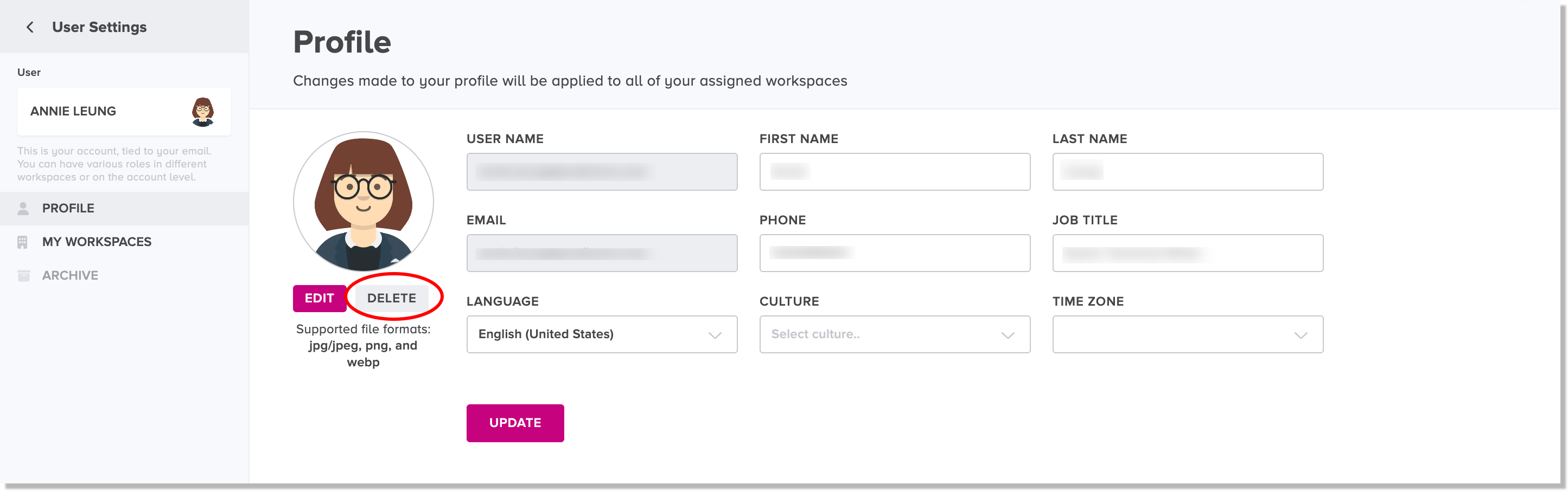 Delete profile image button